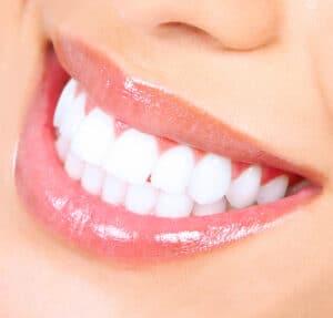 A close-up shot of a woman smiling after going through a cosmetic dentistry procedure